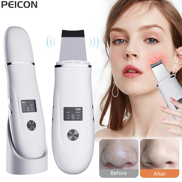 Ultrasonic Face Scrubber Facial Peeling